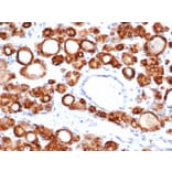 Immunohistochemistry - Anti-Thyroid Peroxidase Antibody [TPO/6417R] (A278074) - Antibodies.com