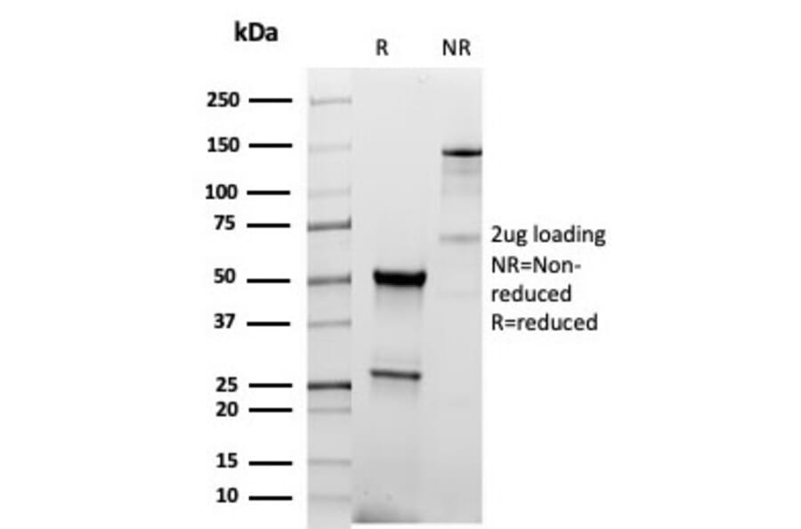 SDS-PAGE - Anti-Thyroid Peroxidase Antibody [TPO/6417R] (A278074) - Antibodies.com