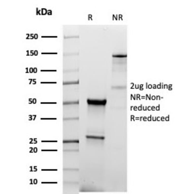 SDS-PAGE - Anti-Thyroid Peroxidase Antibody [TPO/6417R] (A278074) - Antibodies.com