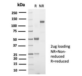 SDS-PAGE - Anti-TSH beta Antibody [TSHb/7001R] (A278075) - Antibodies.com