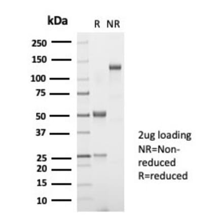 SDS-PAGE - Anti-TSH beta Antibody [TSHb/7001R] (A278075) - Antibodies.com