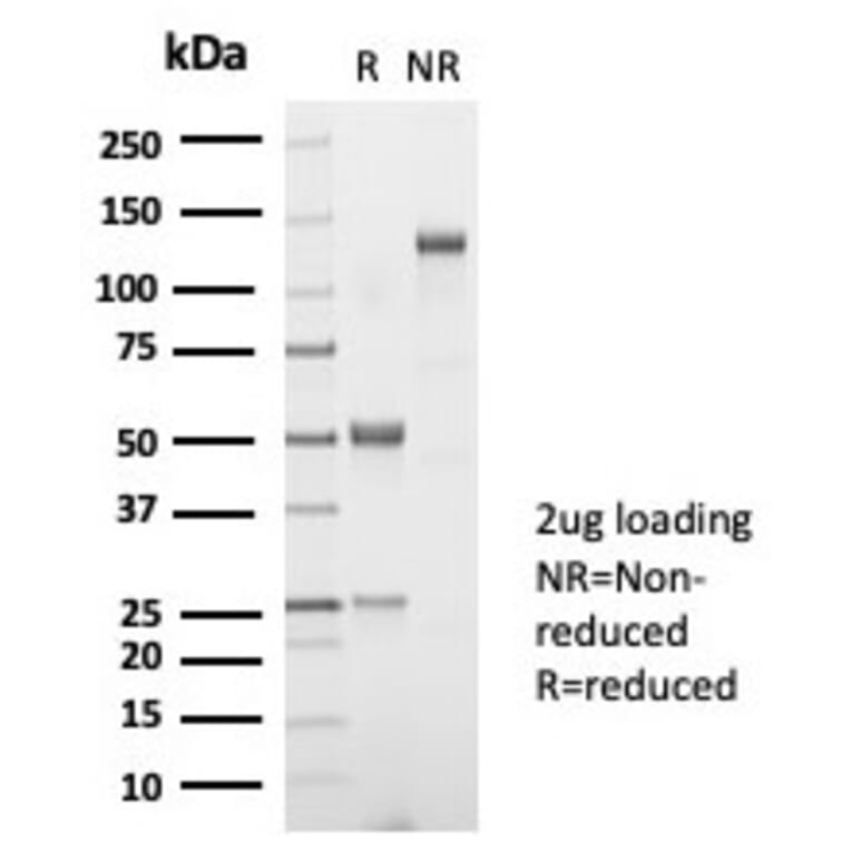 SDS-PAGE - Anti-TSH beta Antibody [TSHb/7001R] (A278075) - Antibodies.com