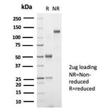 SDS-PAGE - Anti-TSH beta Antibody [TSHb/7001R] (A278075) - Antibodies.com