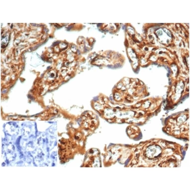 Immunohistochemistry - Anti-Vinculin Antibody [VCL/7091R] (A278076) - Antibodies.com