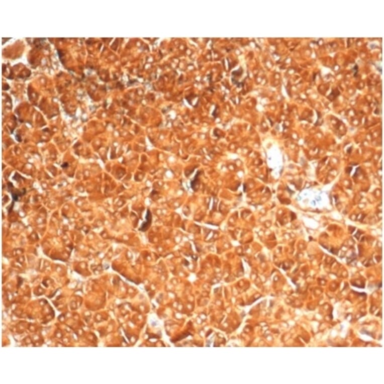 Immunohistochemistry - Anti-Vinculin Antibody [VCL/7091R] (A278076) - Antibodies.com