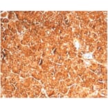 Immunohistochemistry - Anti-Vinculin Antibody [VCL/7091R] (A278076) - Antibodies.com