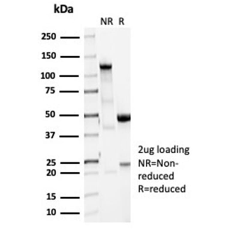 SDS-PAGE - Anti-Vinculin Antibody [VCL/7091R] (A278076) - Antibodies.com