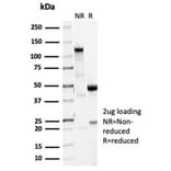 SDS-PAGE - Anti-Vinculin Antibody [VCL/7091R] (A278076) - Antibodies.com