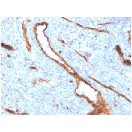 Immunohistochemistry - Anti-Von Willebrand Factor Antibody [VWF/4384R] (A278077) - Antibodies.com