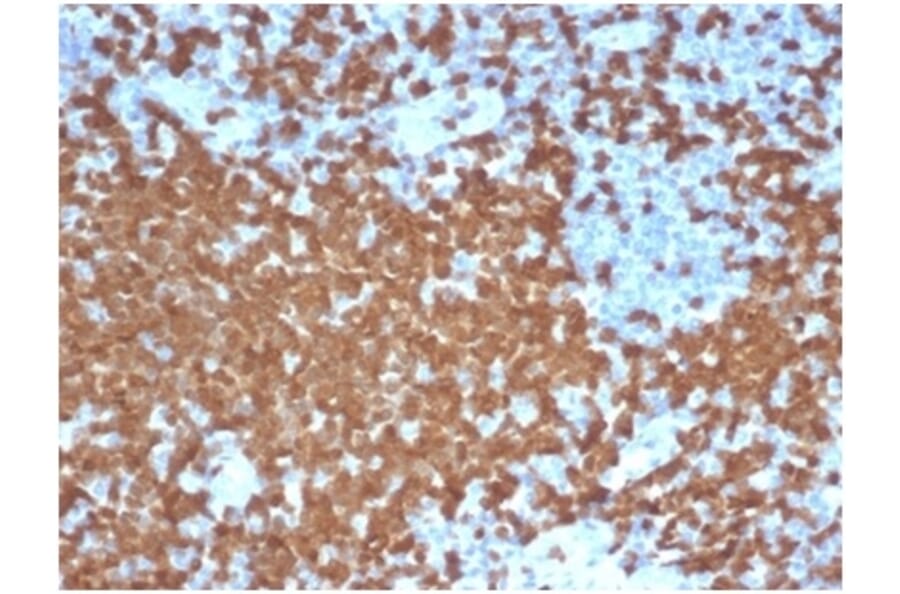 Immunohistochemistry - Anti-ZAP70 Antibody [ZAP70/6492R] (A278078) - Antibodies.com