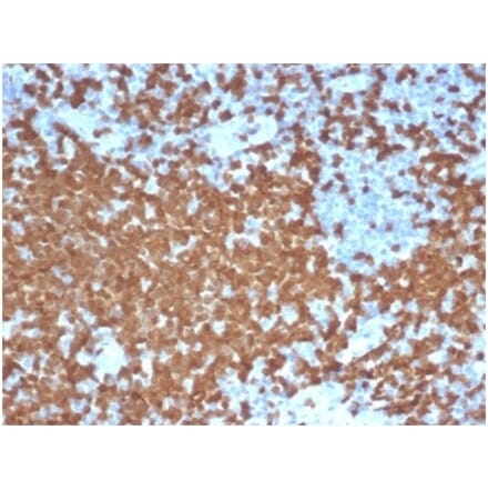 Immunohistochemistry - Anti-ZAP70 Antibody [ZAP70/6492R] (A278078) - Antibodies.com