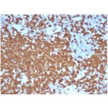 Immunohistochemistry - Anti-ZAP70 Antibody [ZAP70/6492R] (A278078) - Antibodies.com