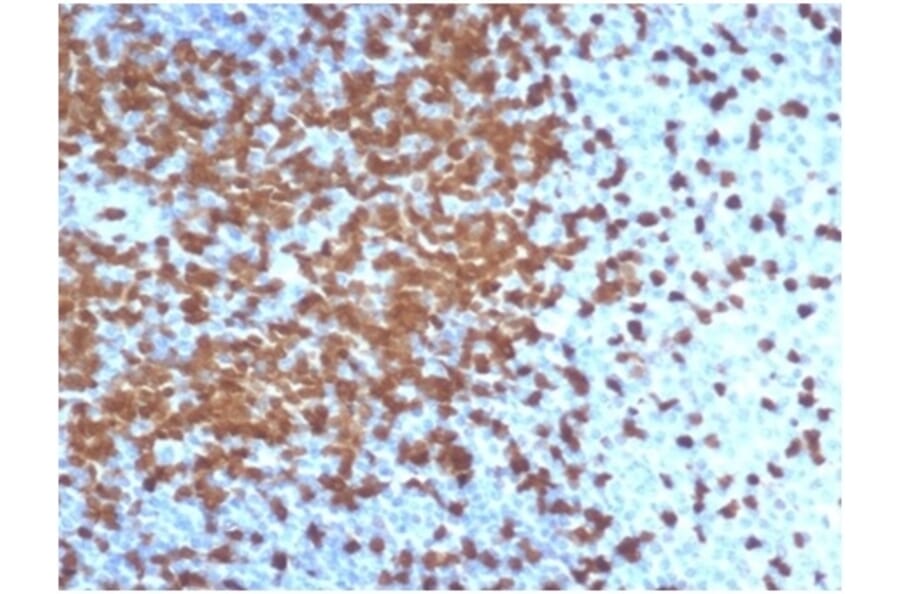 Immunohistochemistry - Anti-ZAP70 Antibody [ZAP70/6492R] (A278078) - Antibodies.com