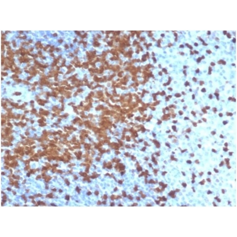 Immunohistochemistry - Anti-ZAP70 Antibody [ZAP70/6492R] (A278078) - Antibodies.com