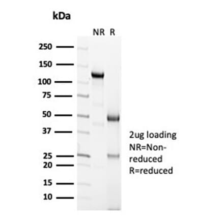 SDS-PAGE - Anti-Calretinin Antibody [CALB2/7029R] (A278079) - Antibodies.com
