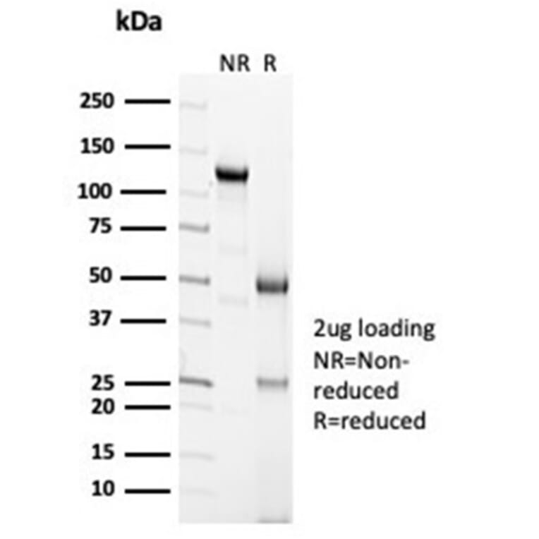 SDS-PAGE - Anti-Calretinin Antibody [CALB2/7029R] (A278079) - Antibodies.com