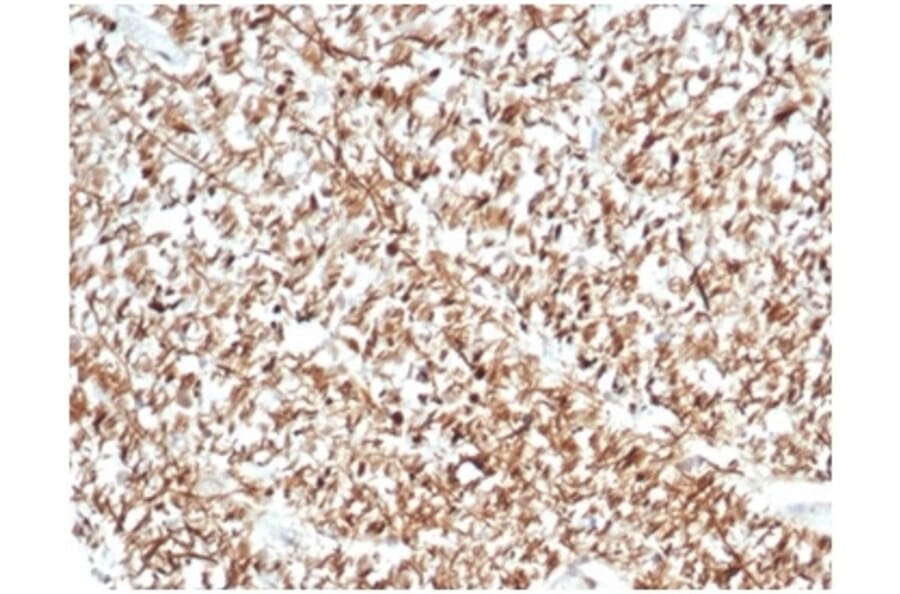 Immunohistochemistry - Anti-Calretinin Antibody [CALB2/7029R] (A278079) - Antibodies.com