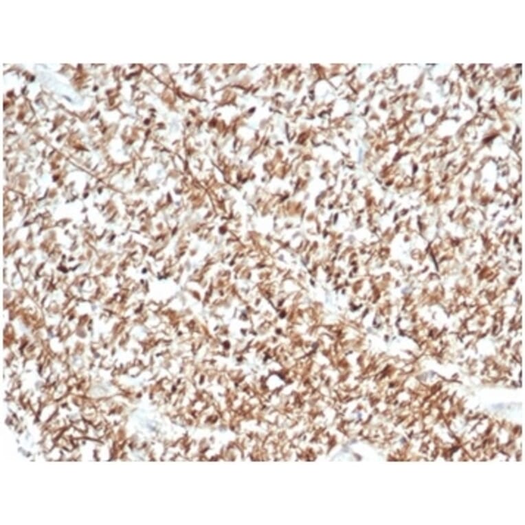 Immunohistochemistry - Anti-Calretinin Antibody [CALB2/7029R] (A278079) - Antibodies.com