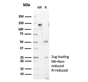 SDS-PAGE - Anti-Caldesmon Antibody [CALD1/7024R] (A278080) - Antibodies.com