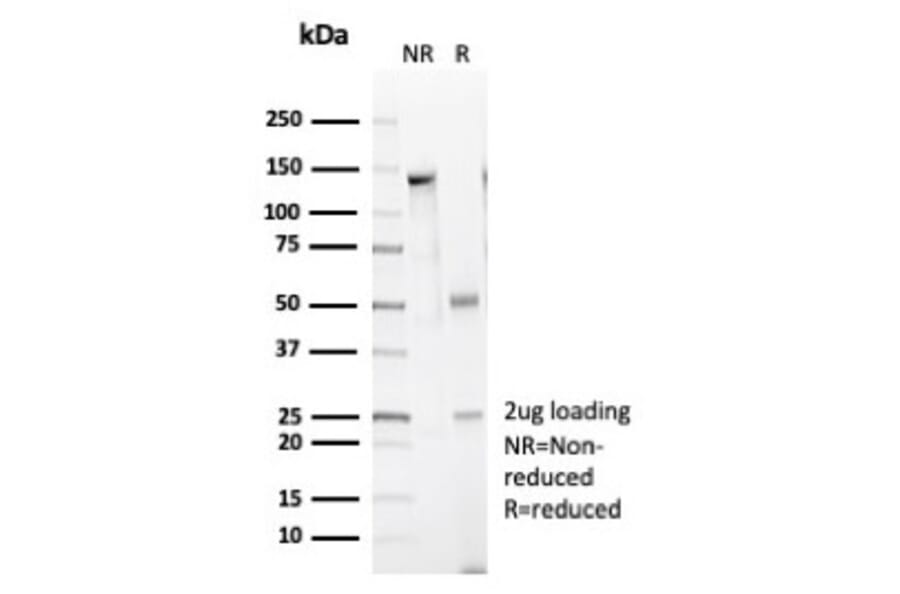 SDS-PAGE - Anti-Caldesmon Antibody [CALD1/7024R] (A278080) - Antibodies.com