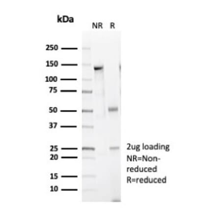 SDS-PAGE - Anti-Caldesmon Antibody [CALD1/7024R] (A278080) - Antibodies.com