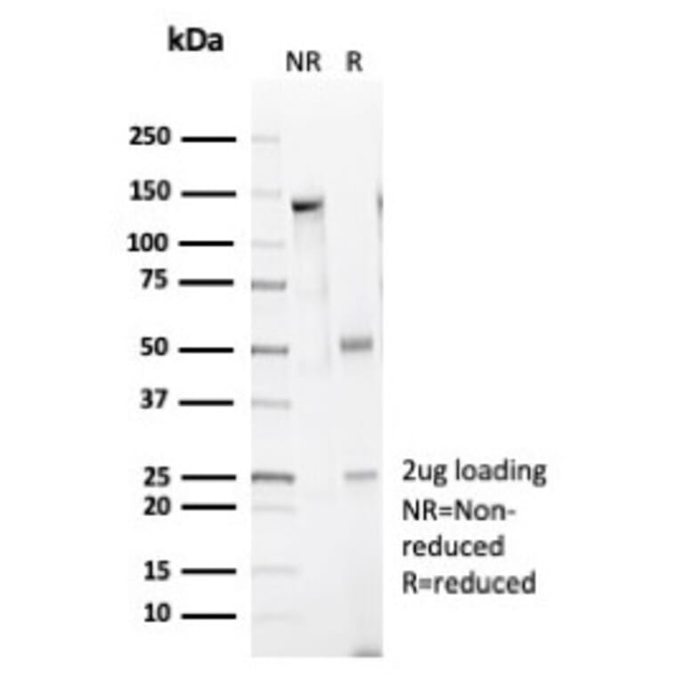 SDS-PAGE - Anti-Caldesmon Antibody [CALD1/7024R] (A278080) - Antibodies.com