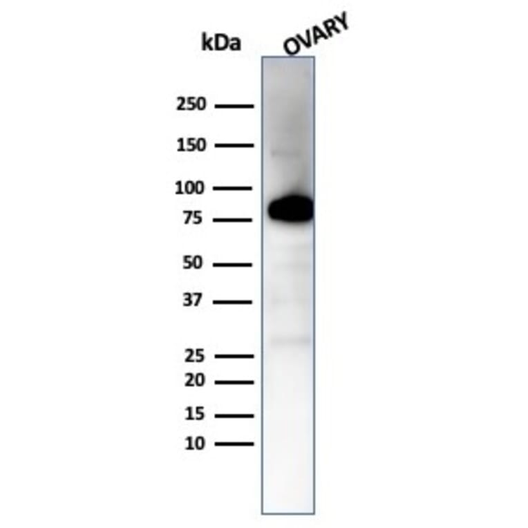 Western Blot - Anti-Caldesmon Antibody [CALD1/7024R] (A278080) - Antibodies.com