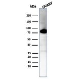 Western Blot - Anti-Caldesmon Antibody [CALD1/7024R] (A278080) - Antibodies.com