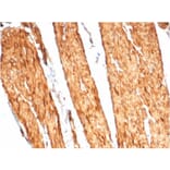 Immunohistochemistry - Anti-Caldesmon Antibody [CALD1/7024R] (A278080) - Antibodies.com