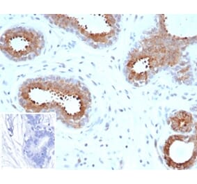 Immunohistochemistry - Anti-BAP1 Antibody [BAP1/6861R] (A278081) - Antibodies.com