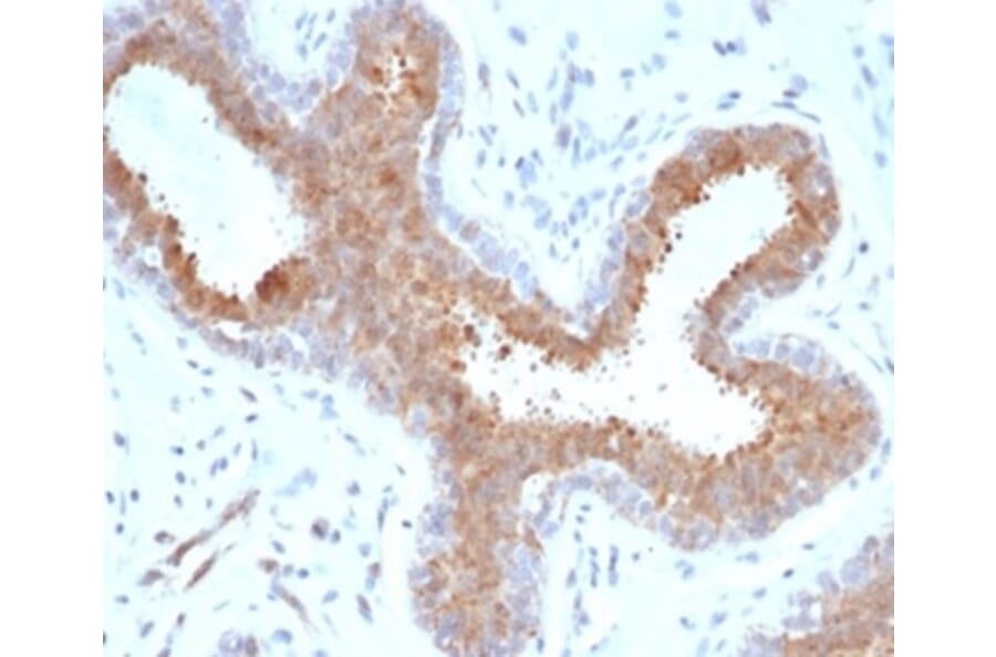 Immunohistochemistry - Anti-BAP1 Antibody [BAP1/6861R] (A278081) - Antibodies.com
