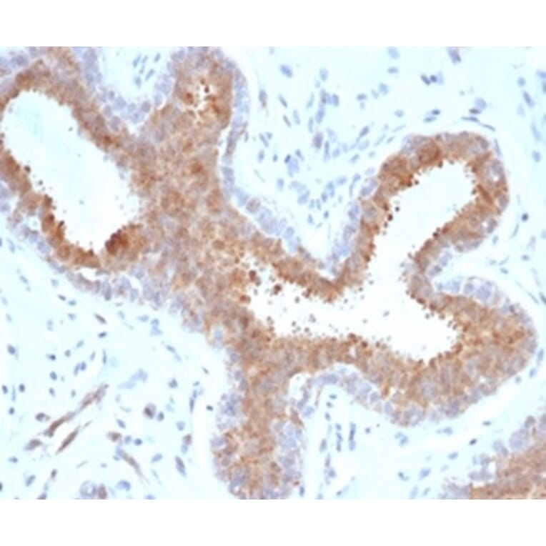 Immunohistochemistry - Anti-BAP1 Antibody [BAP1/6861R] (A278081) - Antibodies.com