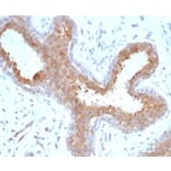 Immunohistochemistry - Anti-BAP1 Antibody [BAP1/6861R] (A278081) - Antibodies.com