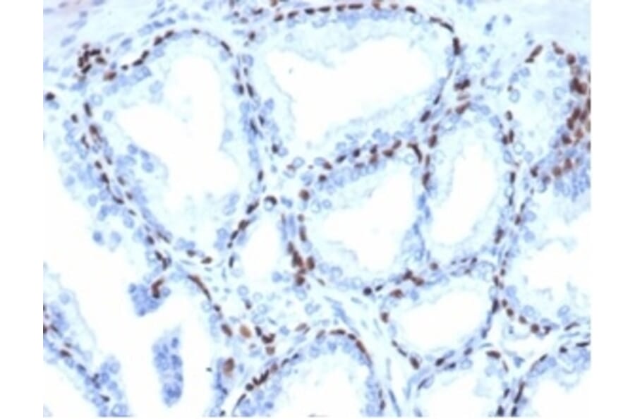 Immunohistochemistry - Anti-p40 Antibody [P40/4396R] (A278083) - Antibodies.com