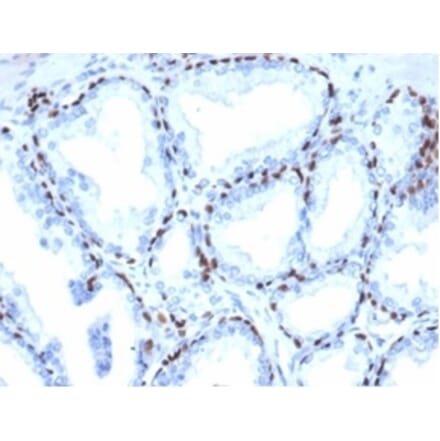 Immunohistochemistry - Anti-p40 Antibody [P40/4396R] (A278083) - Antibodies.com