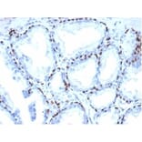 Immunohistochemistry - Anti-p40 Antibody [P40/4396R] (A278083) - Antibodies.com