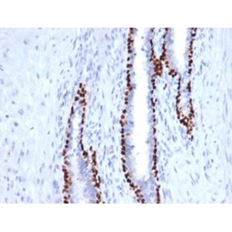 Immunohistochemistry - Anti-p40 Antibody [P40/4396R] (A278083) - Antibodies.com