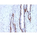 Immunohistochemistry - Anti-p40 Antibody [P40/4396R] (A278083) - Antibodies.com