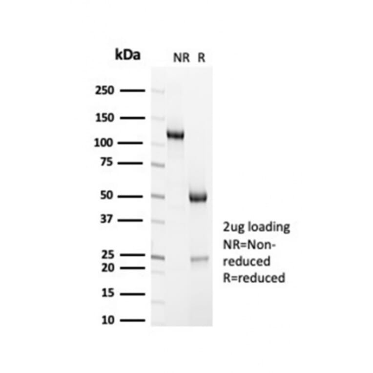 SDS-PAGE - Anti-Sarcomeric Actinin alpha 2 Antibody [ACTN2/7040R] (A278085) - Antibodies.com