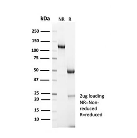 SDS-PAGE - Anti-Cyclin B1 Antibody [CCNB1/7030R] (A278086) - Antibodies.com