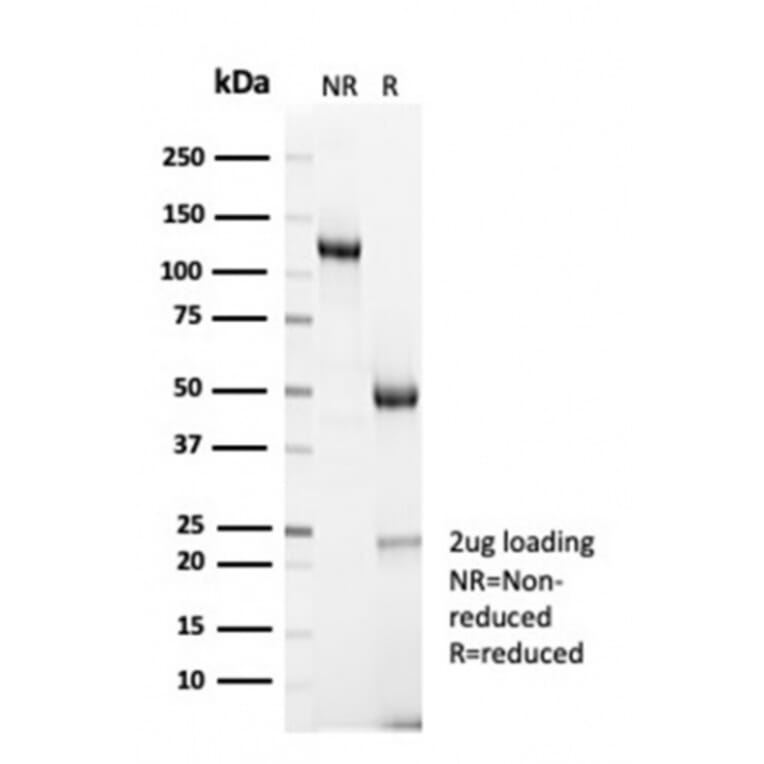 SDS-PAGE - Anti-Cyclin B1 Antibody [CCNB1/7030R] (A278086) - Antibodies.com