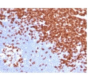 Immunohistochemistry - Anti-CD3 epsilon Antibody [C3e/4652R] (A278087) - Antibodies.com