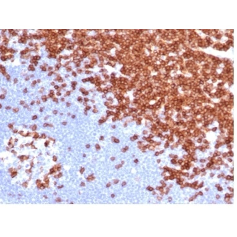 Immunohistochemistry - Anti-CD3 epsilon Antibody [C3e/4652R] (A278087) - Antibodies.com