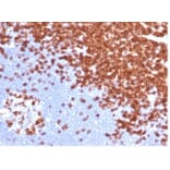 Immunohistochemistry - Anti-CD3 epsilon Antibody [C3e/4652R] (A278087) - Antibodies.com