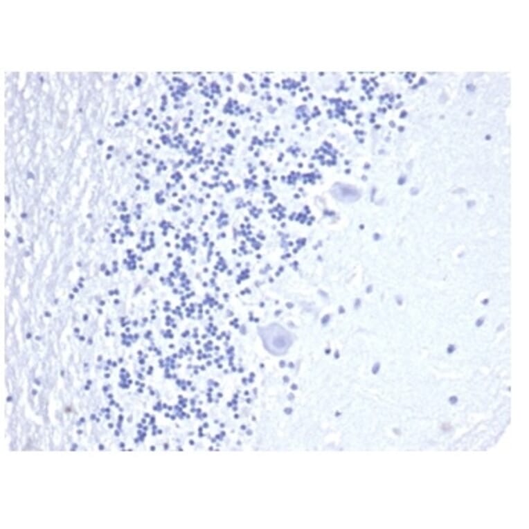 Immunohistochemistry - Anti-CD3 epsilon Antibody [C3e/4652R] (A278087) - Antibodies.com