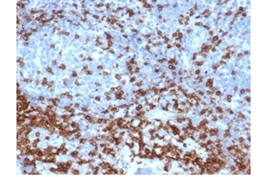Immunohistochemistry - Anti-CD3 epsilon Antibody [C3e/4652R] (A278087) - Antibodies.com