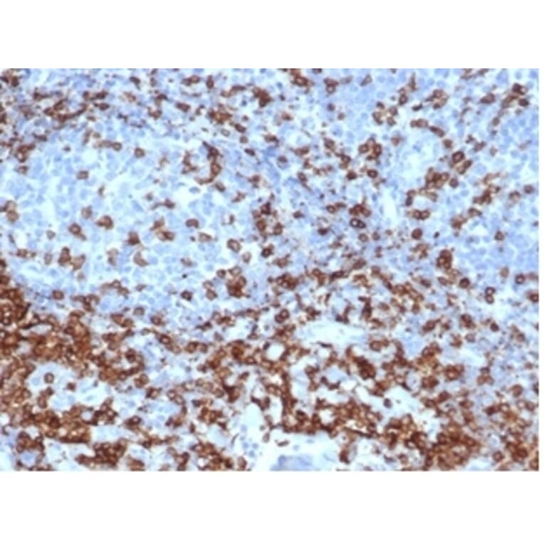 Immunohistochemistry - Anti-CD3 epsilon Antibody [C3e/4652R] (A278087) - Antibodies.com