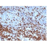 Immunohistochemistry - Anti-CD3 epsilon Antibody [C3e/4652R] (A278087) - Antibodies.com