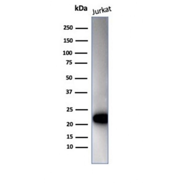 Western Blot - Anti-CD3 epsilon Antibody [C3e/4652R] (A278087) - Antibodies.com