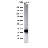 Western Blot - Anti-CD3 epsilon Antibody [C3e/4652R] (A278087) - Antibodies.com